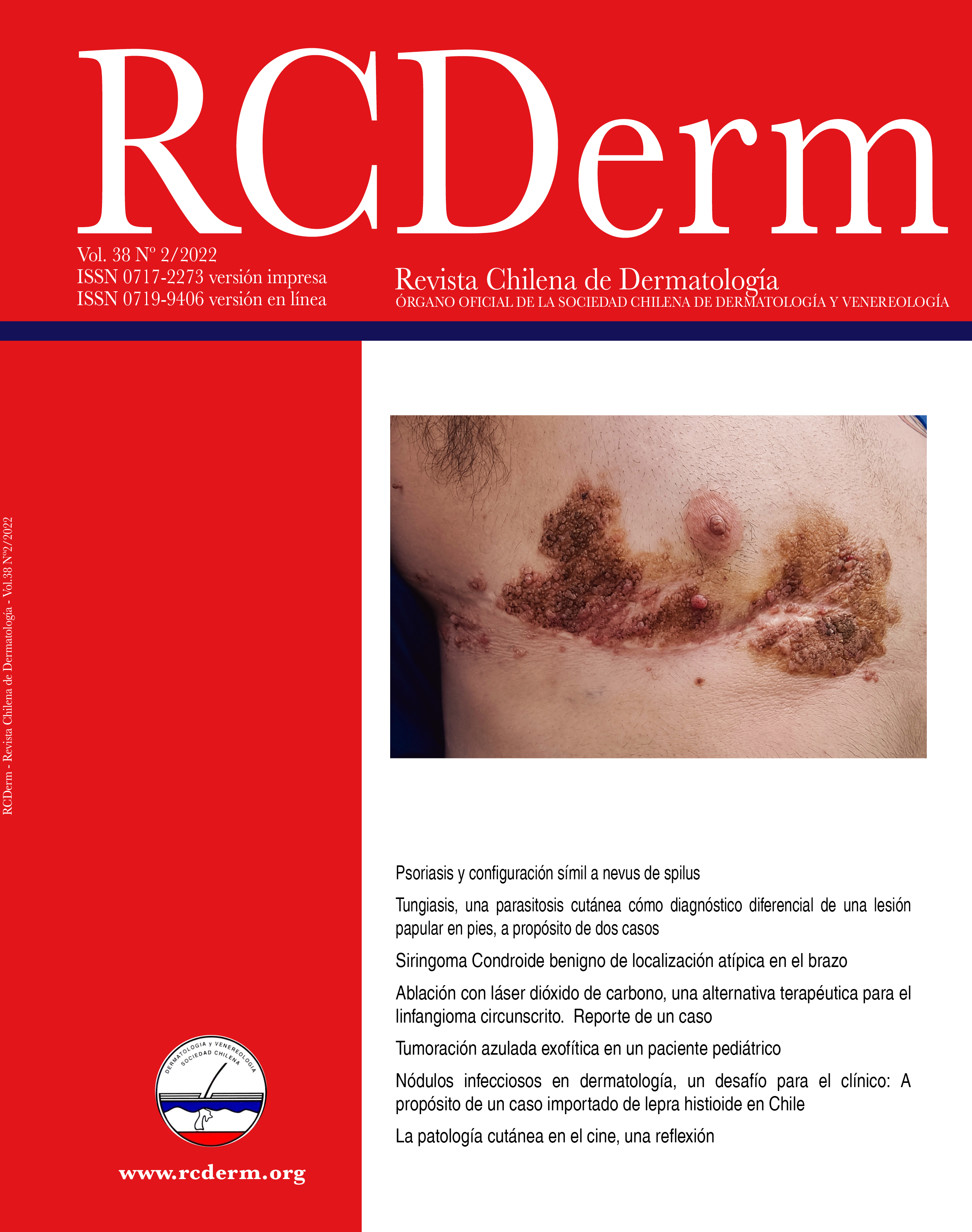 Portada